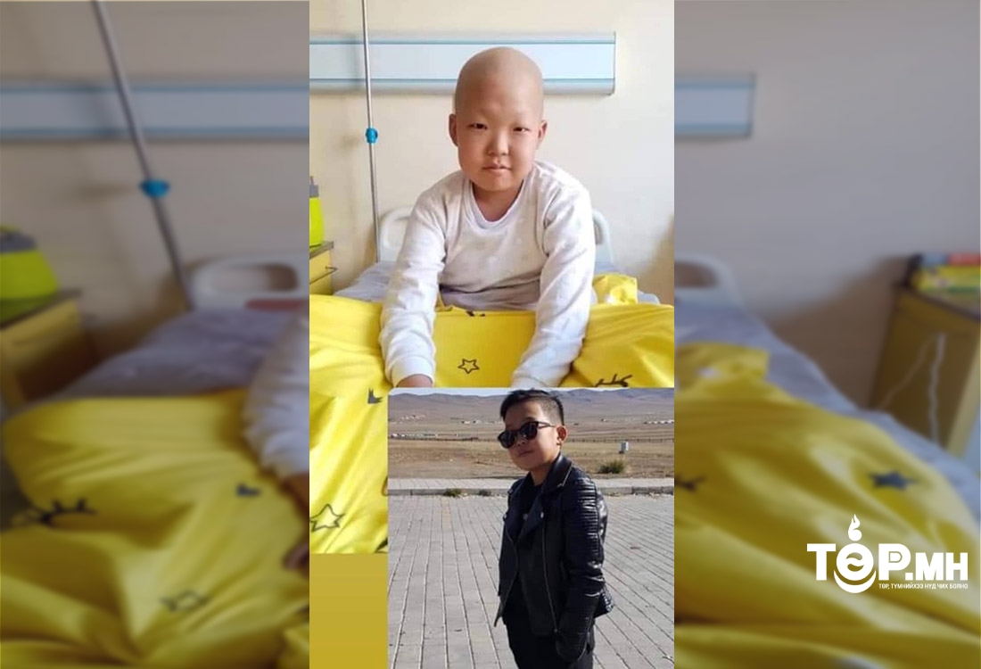 Цусны цагаан эсийн хорт хавдраар оношлогдоод буй 13 настай С.Билгүүн хүүд СЭТГЭЛИЙН ХАНДИВ ӨРГӨЦГӨӨЕ
