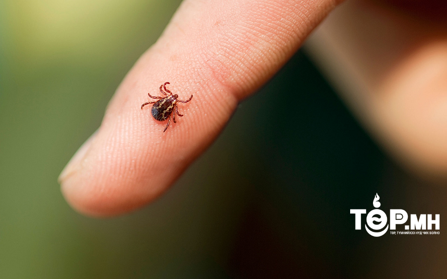 Хачгийн улирлын үед иргэд та бүхэн хачигт хазуулахаас сэргийлээрэй