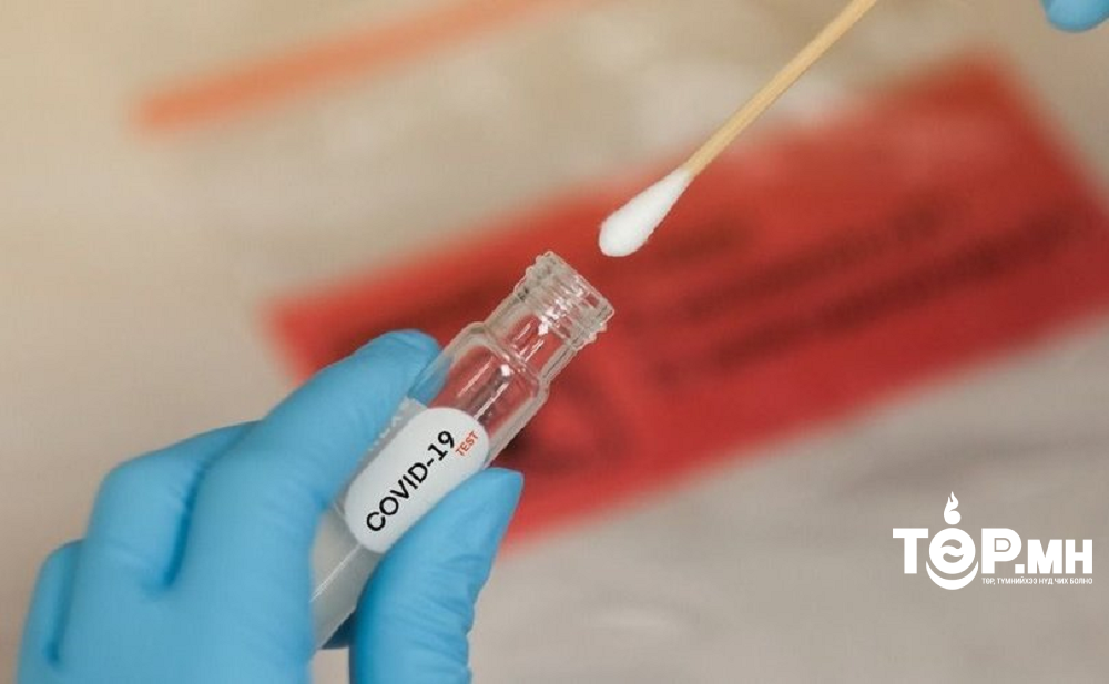 Коронавируст халдварын 151 тохиолдол батлагджээ