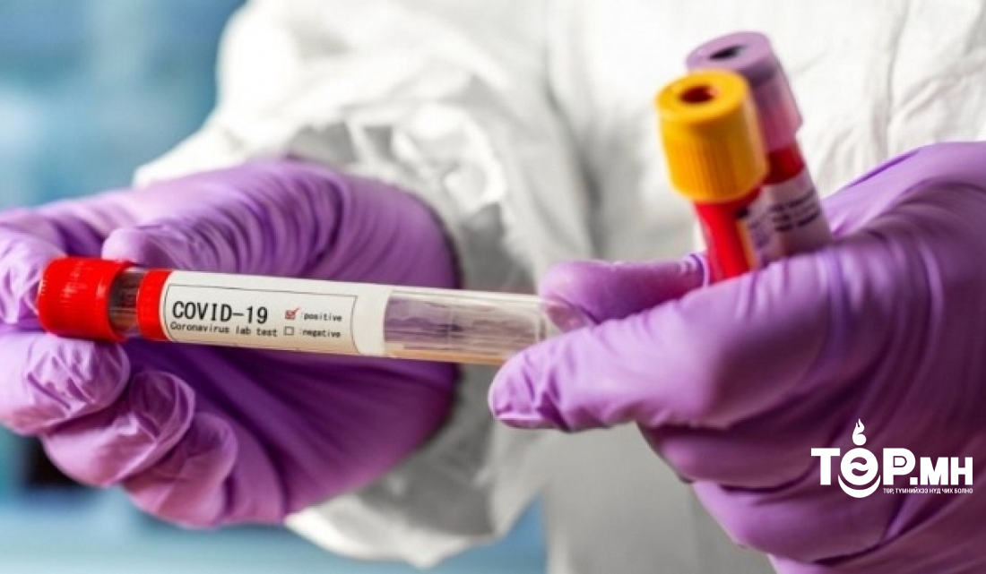 Коронавируст халдварын 64 тохиолдол шинээр батлагджээ