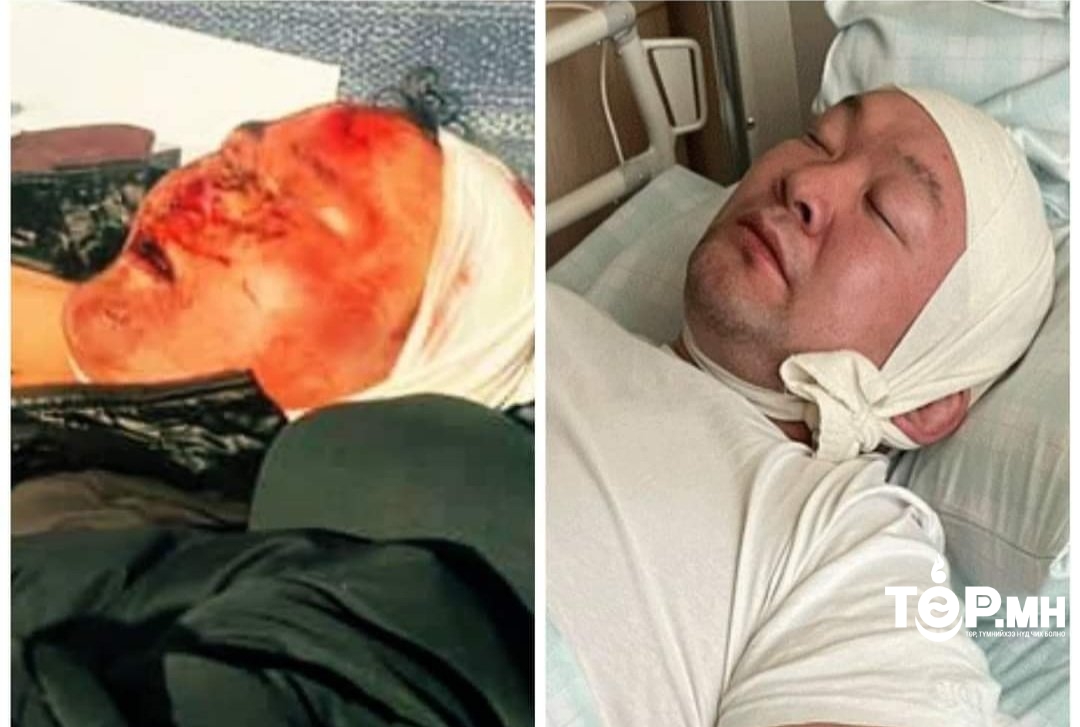 Э.Энхбат начныг ХАРГИСААР зодсон Н.Түвшинбаярын хэргийг шүүх рүү шилжүүлэх эсэхийг өнөөдөр шийднэ