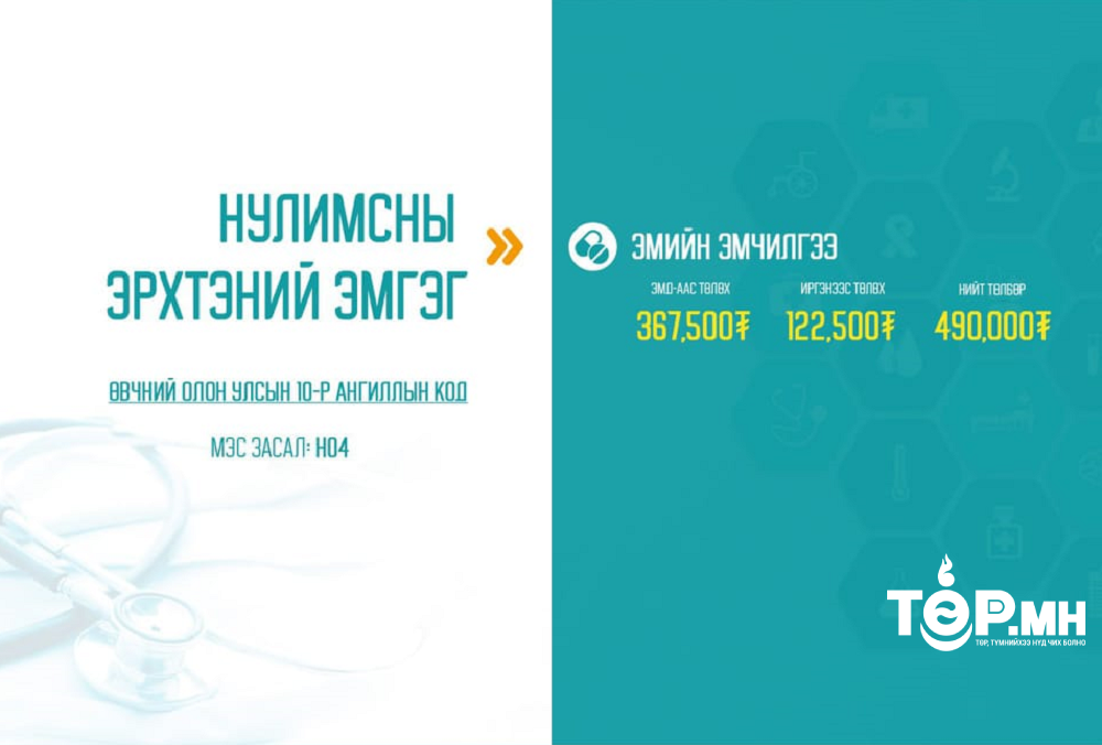 Нулимсны эрхтэний эмгэгийн мэс заслын тусламж, үйлчилгээний 75 хувийг ЭМД-ын сангаас хөнгөлнө