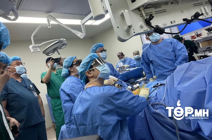 ХСҮТ-д донорын элгийг дурангаар тайрах мэс заслыг нутагшуулж эхэллээ