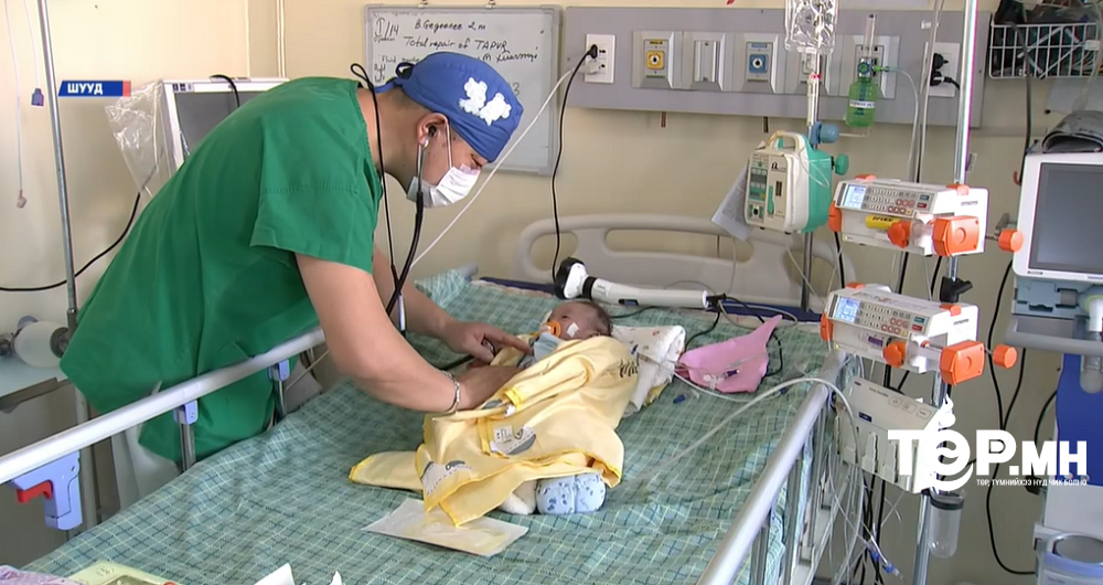 Зүрхний төрөлхийн гажгийн мэс заслын үндэсний баг бие даан хоёр сартай нярайд мэс засал хийлээ