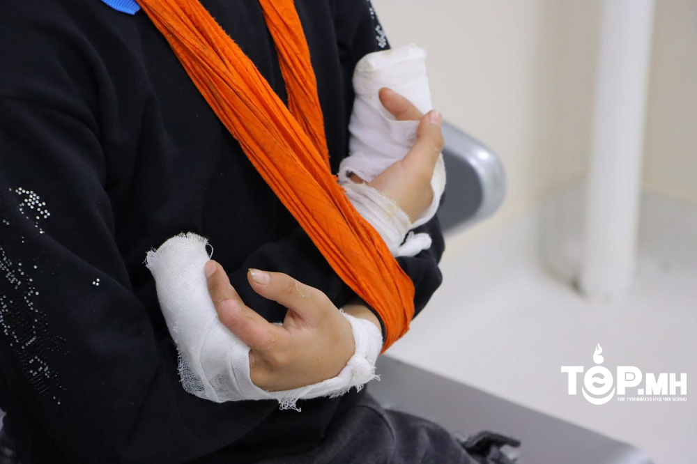 5-14 насны хүүхдүүд чарганаас унаж гэмтэх тохиолдол өндөр байна