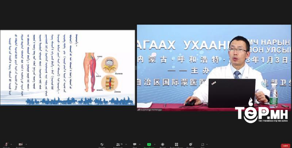 Уламжлалт анагаах ухааны эмч нарын мэргэжил дээшлүүлэх эмнэл зүйн олон улсын сургалт 9 дэх өдрөө үргэлжилж байна