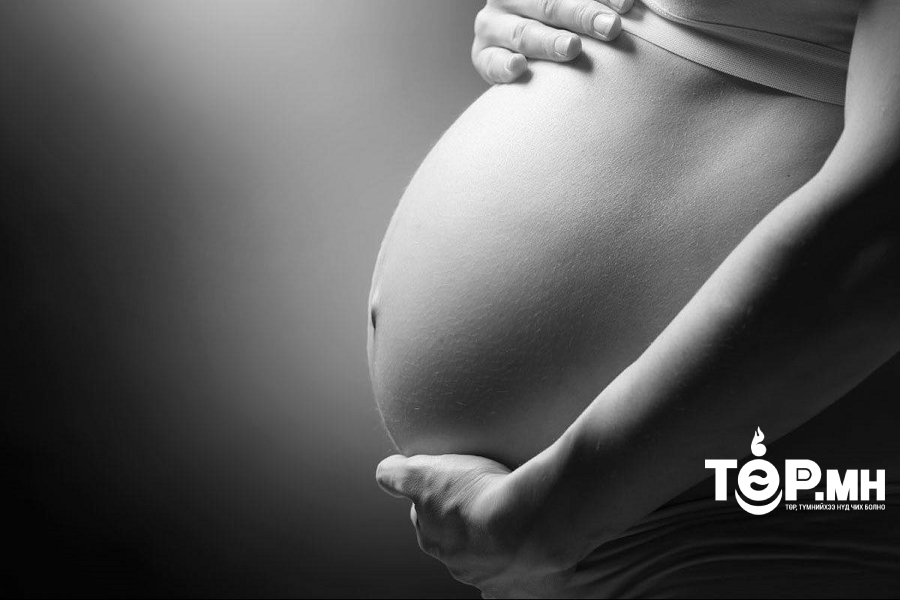 Өвлийн улиралд Улаанбаатарт жирэмсэн эмэгтэйчүүдийн үр зулбах эрсдэл дөрөв дахин ихсэж байна